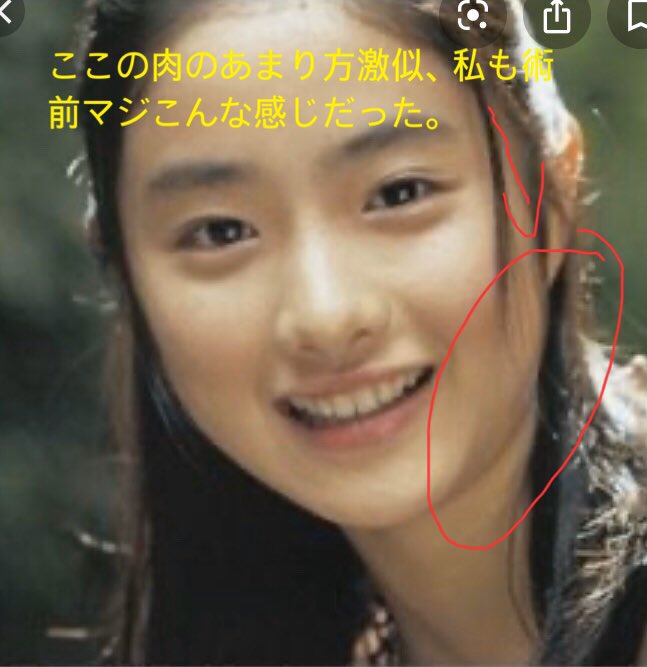 絶望パーツ配置お刺身てゃん 石 さとみのフェイスラインはあれ アキュと輪郭注射やで 背筋鍛えるだけであんな変化する 訳ないやろ アキュやったから分かる あんな感じで首も伸びたもん 私 女優は未整形です 筋トレと食事が大切でー って一般人に