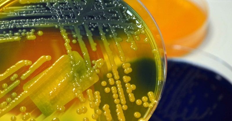 Hospital acquired infections cause more than just physical distress to patients. Interesting article on the mental health aspect of Hospital Acquired Infections
nurse.com/blog/2019/03/2…
#antibiotics #infection #health #treatment #life <a href="/liaonet/">Bill Liao ☯</a> <a href="/SOSV/">SOSV - Deep Tech for Human and Planetary Health</a> <a href="/RebelBio/">RebelBio</a>