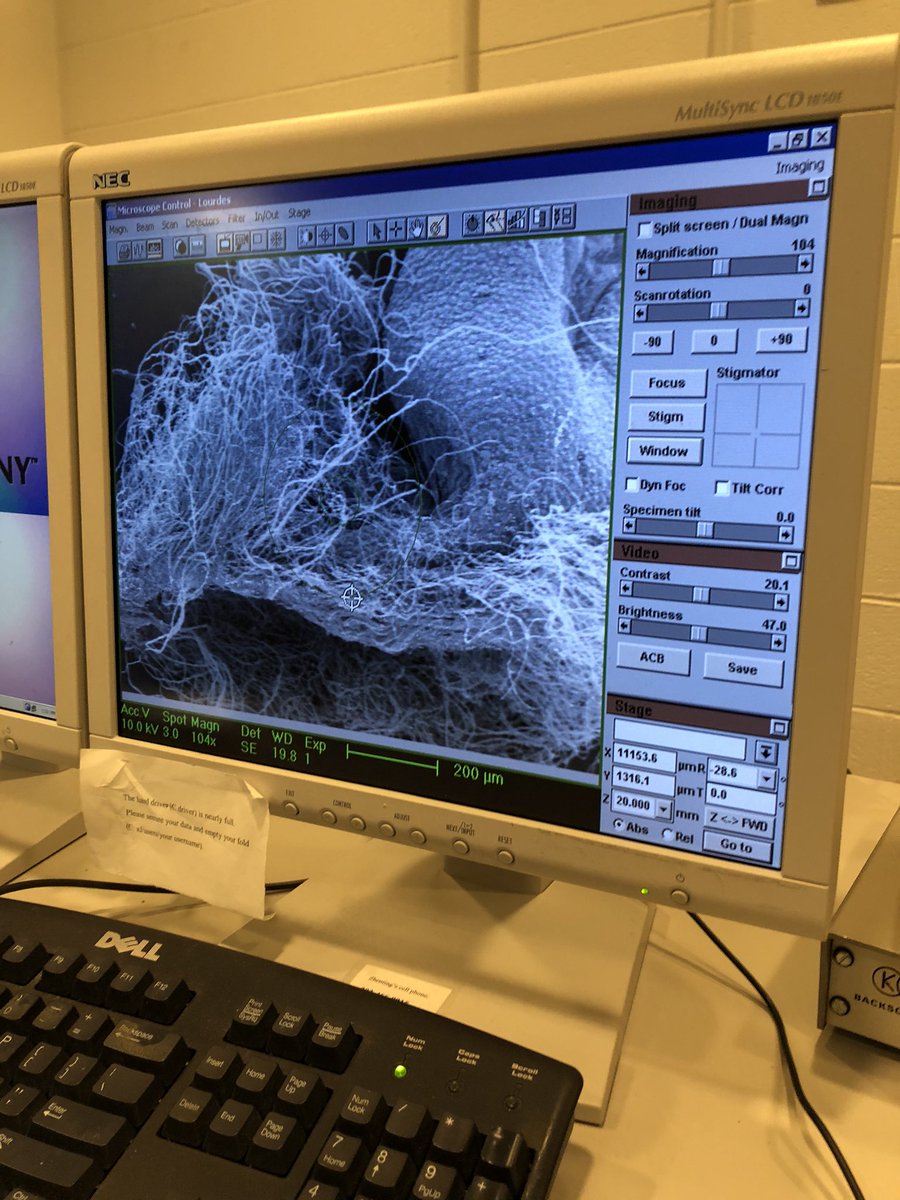 planktomancer's tweet image. Scanning fired nematocysts of an Erenna laciniata tentillum! #SEM #siphonophore #SiphWeb