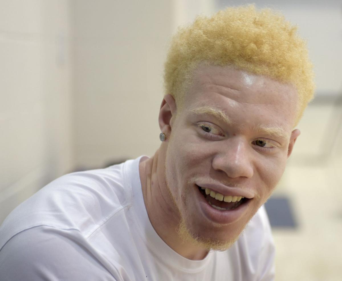 Белый негр. Альбинос негроидной расы. Актеры альбиносы. Негр альбинос актёр американский. Альбинос баскетболист.