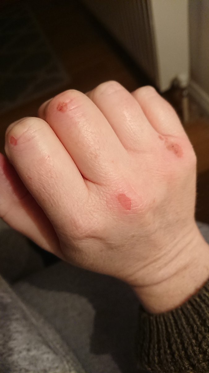 Chloe_Set tweet media