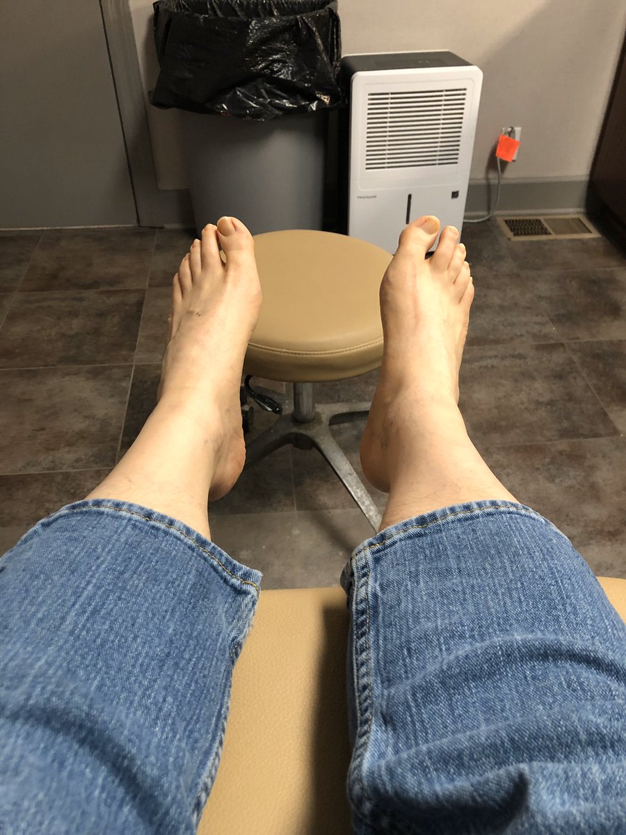 josephakins's tweet photo. What your feet look like before having them molded https://t.co/6vKsM6mI89
