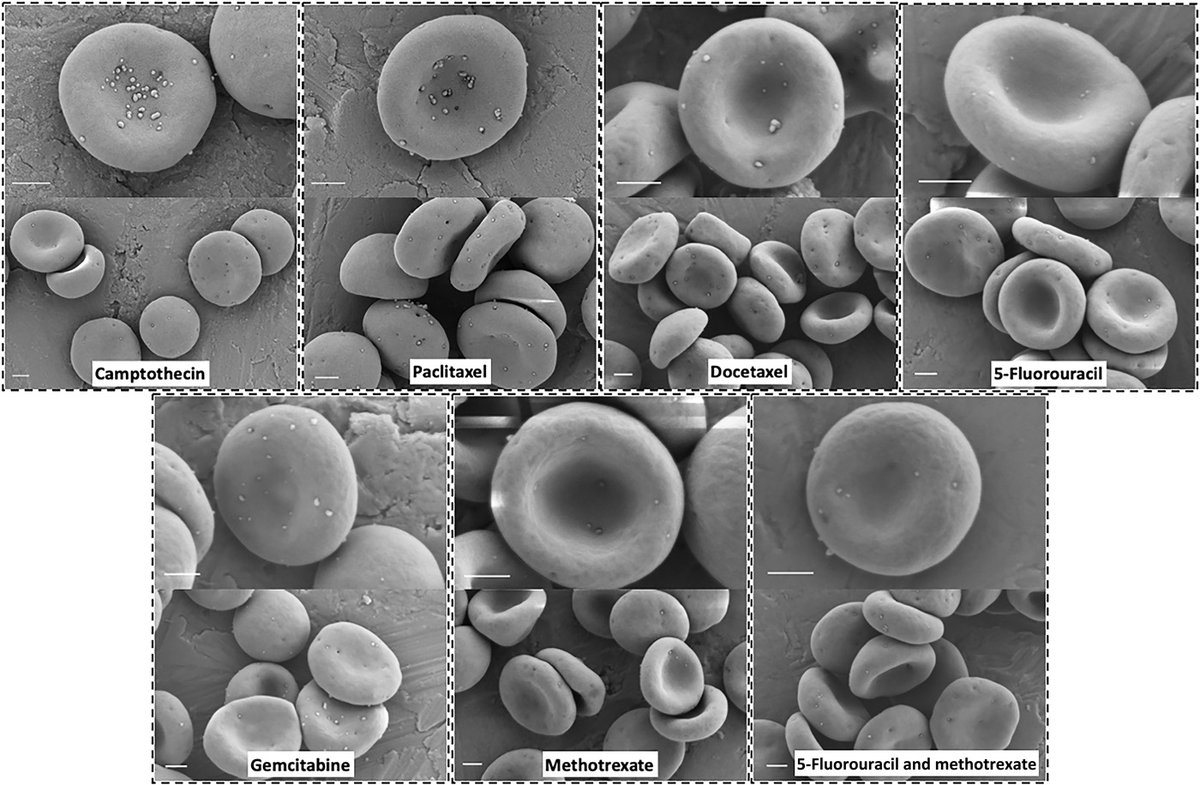 ScienceMagazine's tweet photo. Nanoparticles containing chemotherapeutic drugs and “hitchhiking” on red blood cells treat cancerous lung tumors more successfully than nanoparticles delivered alone, a recent mouse study in @ScienceAdvances shows. https://t.co/T6AzDOIVD8 https://t.co/zb6pgZLL1N