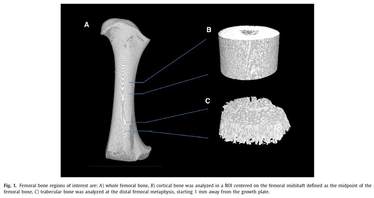 Also #openaccess in #JournalCF, alterations of bone microarchitecture and composition at birth in #cysticfibrosis pigs suggest bone defects may be a primary aspect of disease.
ow.ly/xFKF50xObrF