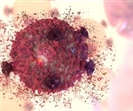 zoologicalscinz's tweet photo. Certain bacteria can override programmed #cell death?
 
Certain #bacteria can override a defense mechanism of the #immune system, so called programmed cell death, through inhibition of death effector #molecules by their outer membranes components.

Visit:https://t.co/DT2EbFCC88 https://t.co/Wqys6GHF1P