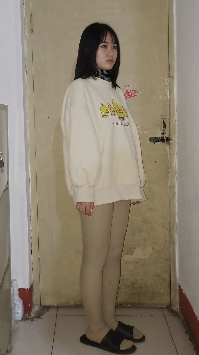 AandBcherry1's tweet photo. アイテム：太もも��脂肪吸引
医師：曾志権
病院：重慶医佑美曾志権医療美容
住所：中国重慶
価格：太ももの脂肪吸引 3800RMB、全身脂肪吸引 16800RMB
全身麻酔 : 2000RMB
局所麻酔：無料 
#脂肪吸引 #脂肪燃焼 #脂肪移植 https://t.co/za9Qe77bTv