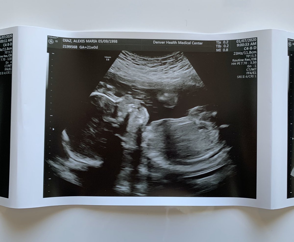 Alexis_Diaz00's tweet photo. My biggest blessing of 2020💕 https://t.co/q787i9YNtr