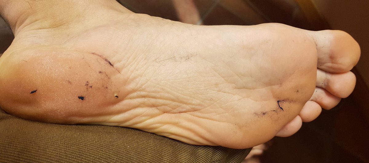 AlexMasterFeet1's tweet photo. @Goddesslou24x Almost as mine Miss 🤣🤣🤴 https://t.co/0wBdd3VvA3