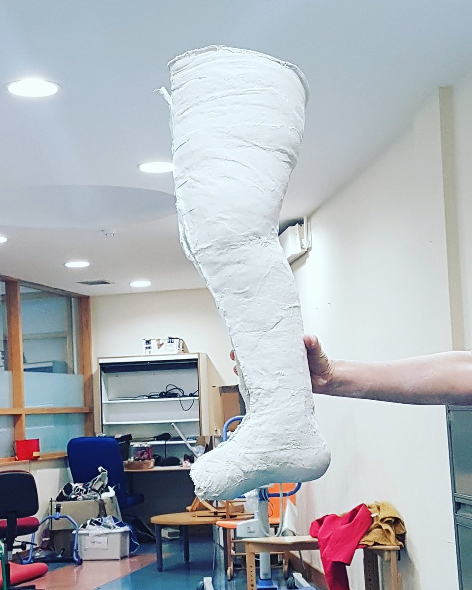 TheHotWheels93's tweet photo. I was fitted for a new state of the art carbon fibre cast today because of the kindness of @TheNotoriousMMA I owe him and @John_Kavanagh my life They done so much for me . Please share this. sometimes the positive stuff doesn't go as far as it should. Conor has changed my life💛 https://t.co/mDmVTiQVgP