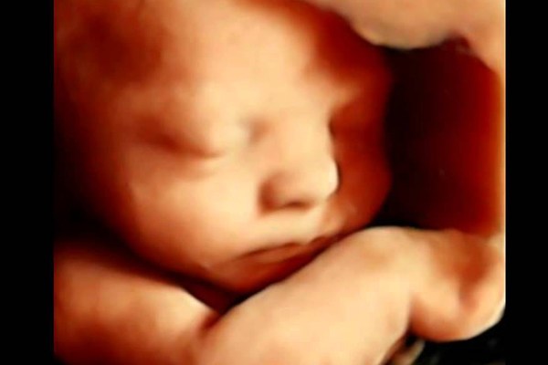 4D Movie Star Baby Scans - mailchi.mp/74b3d7fe66ae/4…