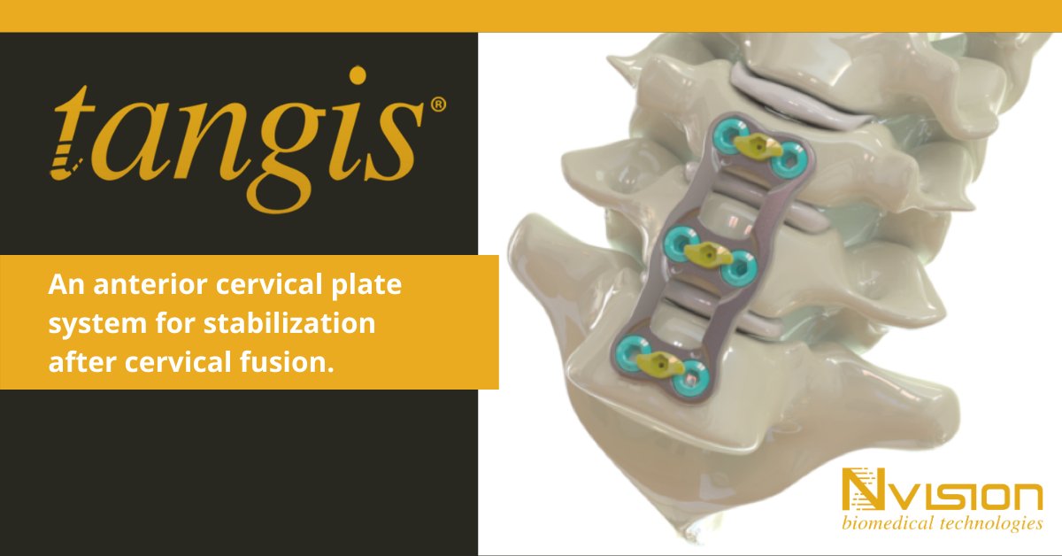 Interested in learning about the simple, versatile Tangis® Anterior Cervical Plate System? Click the link or contact us today to learn about the product features how it can assist in a better anatomical fit. bit.ly/2LM7Pd9. #fixation #spinesurgery
