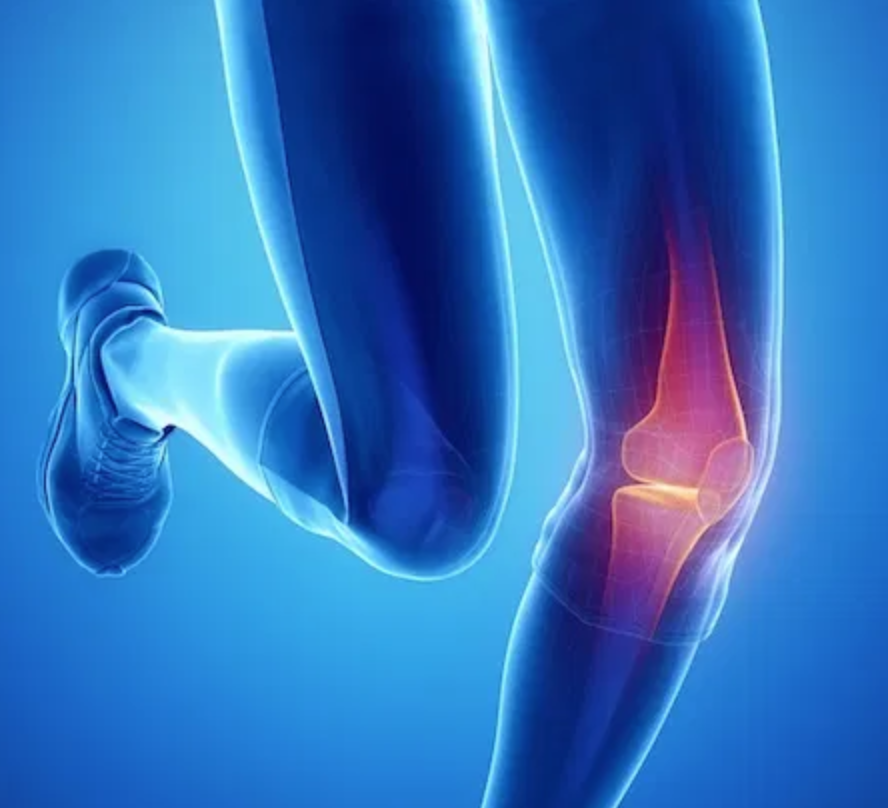 MillettMD's tweet photo. (continued)
Dr. Millett will perform a #Lachmantest and a #PivotShiftTest to pinpoint how much the tibia moves in relation to the femur (upper leg bone). He will also obtain a number of imaging tests such as X-rays and an MRI. Learn more here: https://t.co/LRB2aJcVea https://t.co/sPsaQHZUaJ