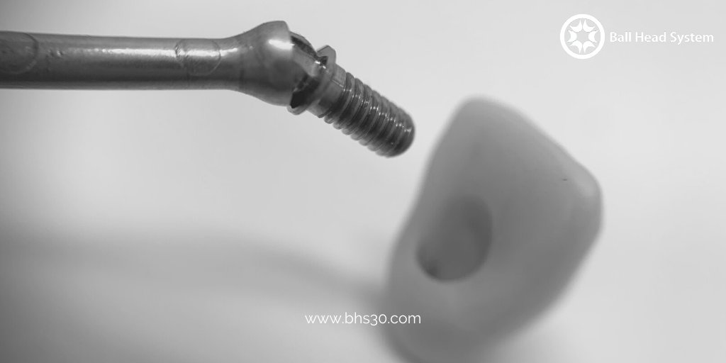 BallHeadTech's tweet image. The evolution towards customization in 🦷 #DentalProsthetic design increasingly requires the use of #AngledAbutments to provide versatility, simplicity and ease of use.

Did you know that our solutions are pioneers in covering these needs? ✅👉bit.ly/2T2spbW