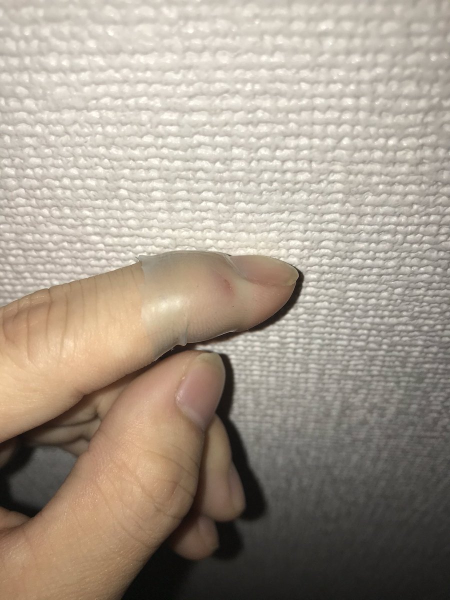 なやすお 紙でシュッってやった傷みたいな時とか創傷とか よく傷を作るんだけどその時必ずと言っていいほどコンドーム を使う ワセリン コンドームが基本 こんな感じ いっぱい使えるから便利だよ 男女共にコンドーム持ち歩くことはオススメしてる なやすお 紙でシュッってやった傷みたいな時とか創傷とか よく傷を作るんだけどその時必ずと言っていいほどコンドーム を使う ワセリン コンドームが基本 こんな感じ いっぱい使えるから便利だよ 男女共にコンドーム持ち歩くことはオススメしてる