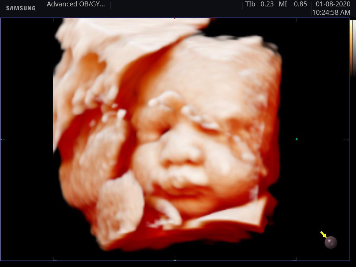 CaliSkysMommy's tweet photo. So in love with my son, I can’t even deal with his perfect little lips!! #32weeks3days 🥰💙 https://t.co/OlWrbH2VCg