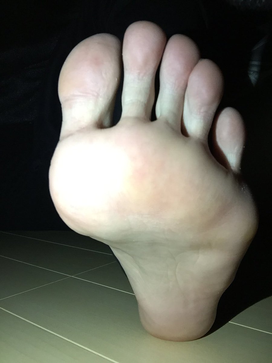 痣ができるくらい叩かれたりもしてみたい