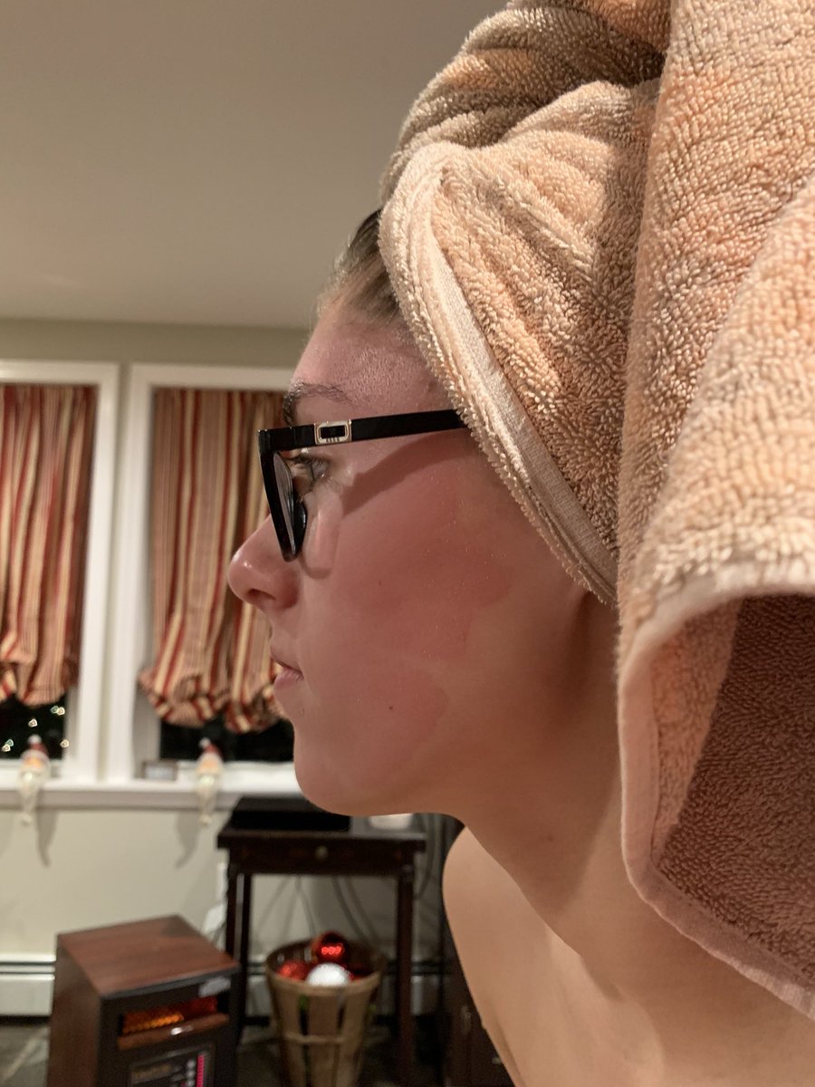 elizabethdejong's tweet photo. @yesto This happened to me a few weeks ago, I thought my skin was just sensitive. https://t.co/Xrrug3B7Mq