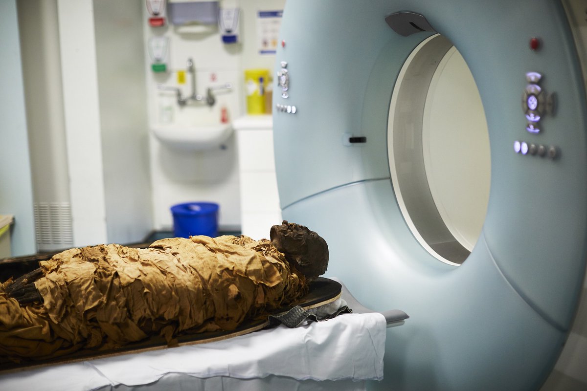 The remains of the mummy Nesyamun on a hospital bed before a CT scan was undertaken at Leeds General Infirmary