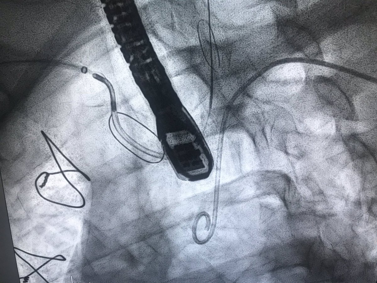 Rodrigo Estévez tweet media