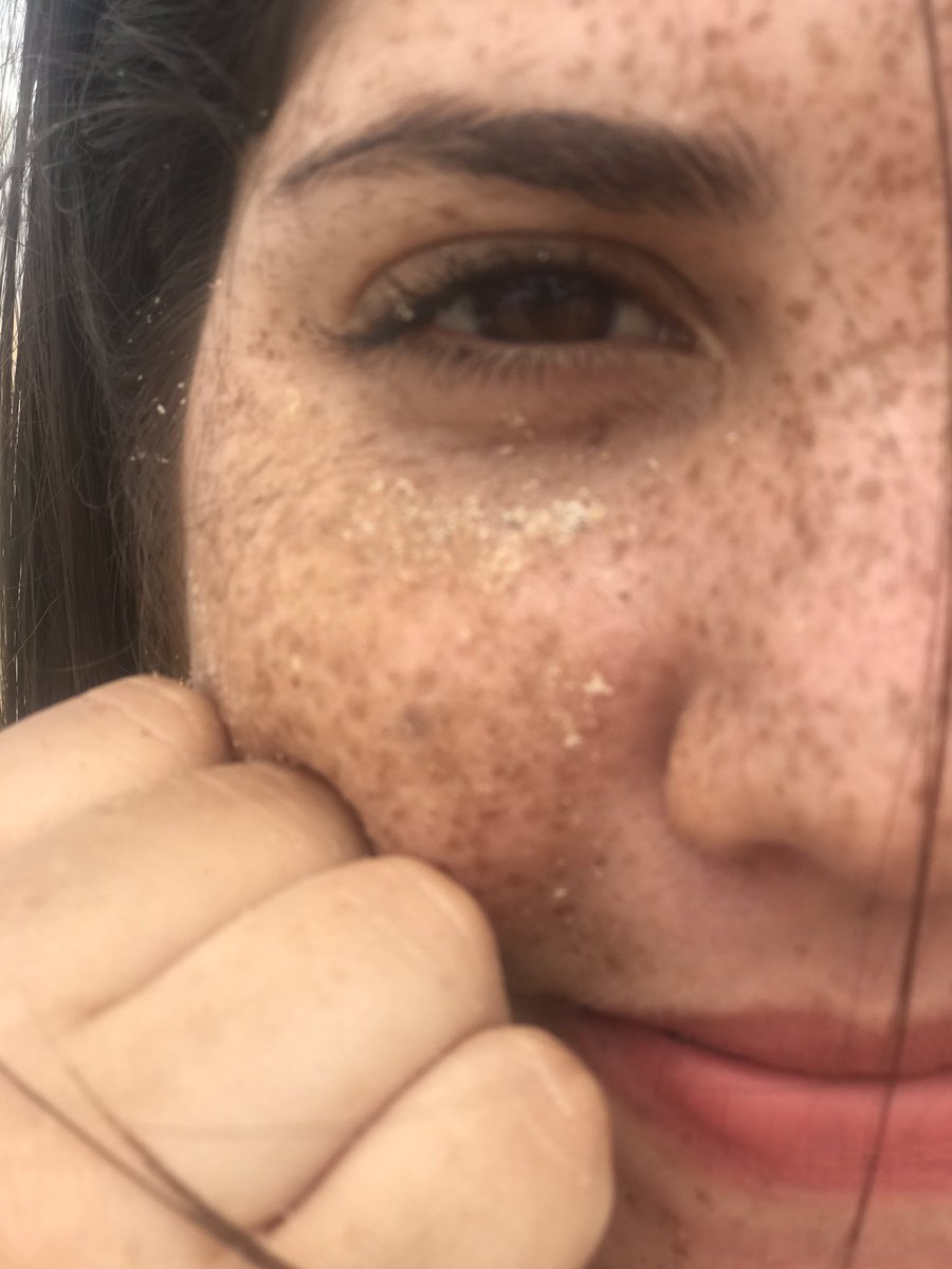 fiogallati's tweet photo. Cuando era más chica la gente me miraba como si fuese un bicho raro por mis pecas y hasta me decían que me trate para apagarlas. Hoy en dia creo que es una de las cosas más lindas que tengo 🙈💜 https://t.co/EXoDUvlR4Y
