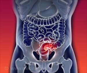 HealthMDoctor's tweet photo. Health:Tumors>Gut Bacteria Linked to Increase of Colorectal Cance-- https://t.co/WyZjOM0tbG #health https://t.co/5mAEEv2XJc