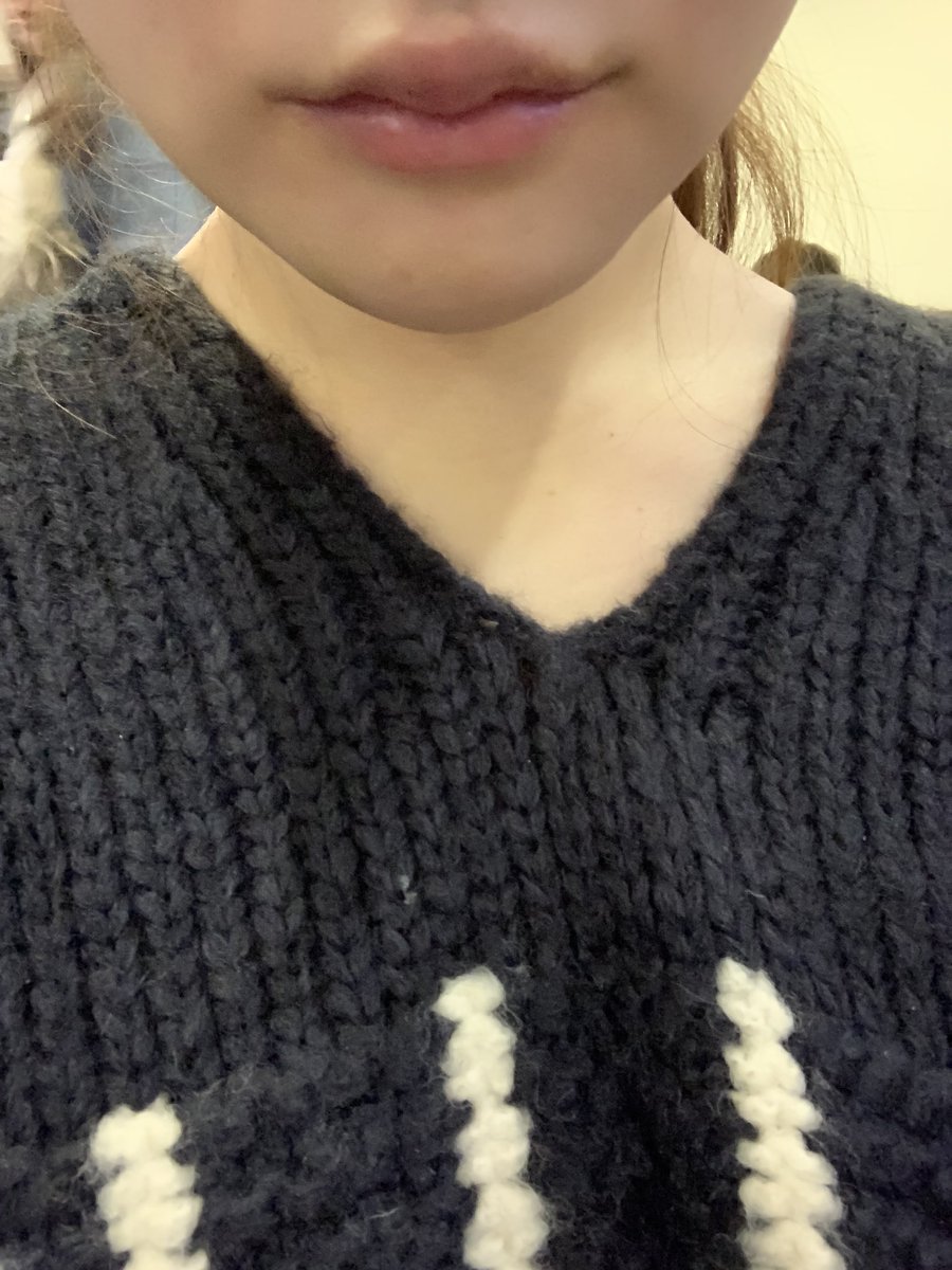 seikeibibibi's tweet photo. ミニV 4日目
まだまだまだ全然痛いよー
腫れは昨日と変わらないように思う。
咀嚼しよーと思えばできるくらいには口開くけど、その後必ず顎痛くなる。
痛みと腫れ以外は特になにもない！
とにかく痛くなくなってほしい（ ;  ; ） https://t.co/Xwp1suC185