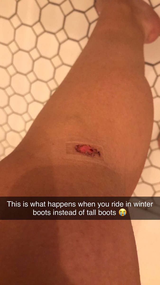 twoottbs's tweet photo. Please use me as a cautionary tale and always wear proper leg protection when you ride 😭

(Also the saddle I’ve been riding in is slightly small so that didn’t help 😅) https://t.co/Xf0WDmdc5T