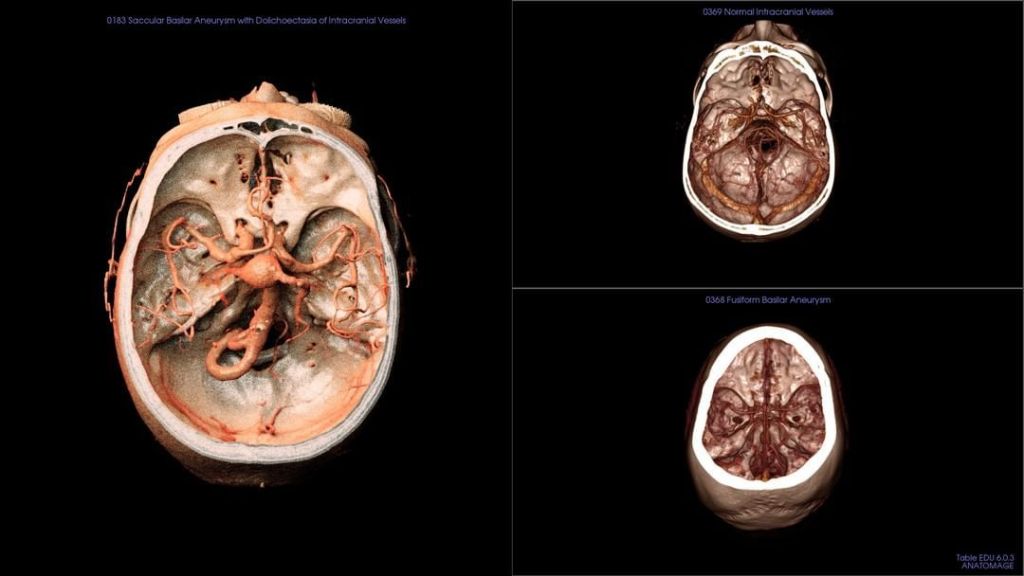 no1_doctor's tweet image. With more than 1,500 #DICOM cases, the #AnatomageTable library is an essential t… dratef.net/with-more-than…