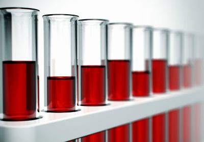 PortalOnconews's tweet photo. Estudo apresentado no #ASCOGI20 mostra resultados encorajadores de um exame de sangue que utiliza o DNA circulante para identificar sinais de metilação de tumores gastrointestinais difíceis de detectar - https://t.co/9nF8GJzCMd @ASCO #GI20 #ONCONEWSnoASCOGI20 #ONCONEWS https://t.co/HHn1oPW1Hn