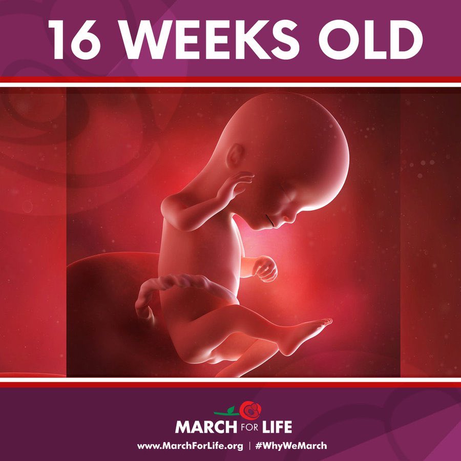 MarchforLifes's tweet photo. At 16 weeks, a pre-born baby:
Has fingerprints
Can blink
Has teeth
Can hear
Has hair
Can legally be murdered in 51 states https://t.co/VRM328VIay