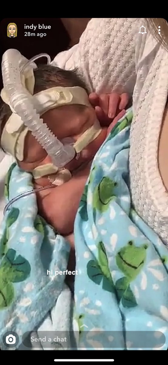 indysinhaler's tweet photo. it ain’t easy being wheezy baby!! https://t.co/s9O1ACiDtL