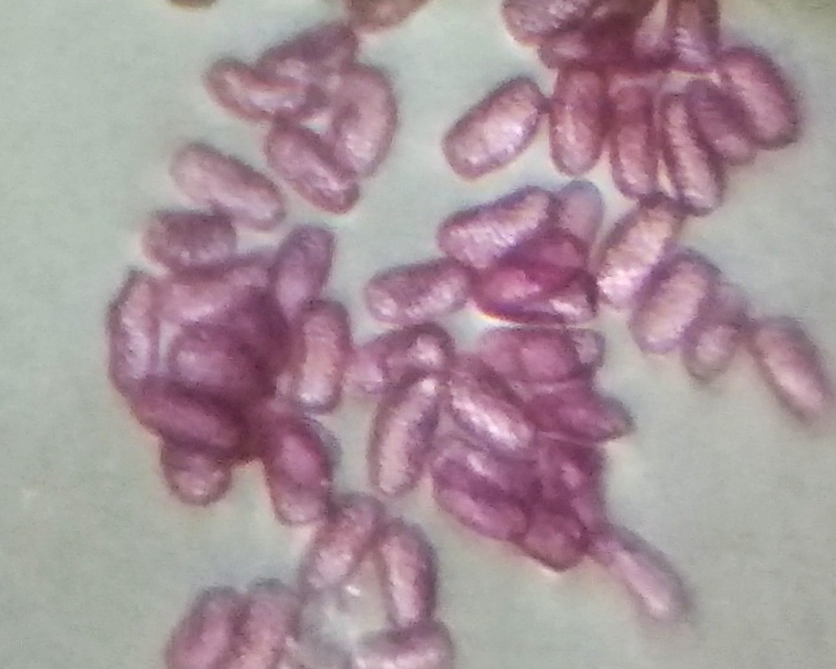 Edurafi's tweet photo. For the first time I saw a pink pollen. Many plants may have pink pollens but this was 1st for me. These r pollens of Impatiens. Photographed with d @TeamFoldscope. Interested in learning more abt what determines d colour of pollens. #scicomm #science #sciencetwitter https://t.co/iOsj3fxgWE