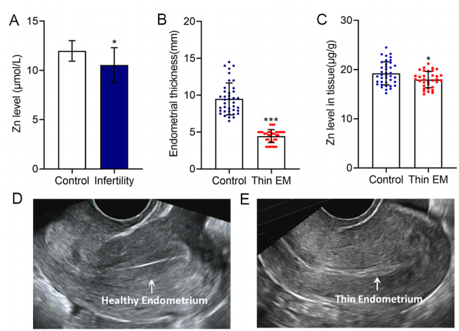 AJPCellPhys's tweet photo. #Translational #Physiology Alert! Lu et al. explore the #antioxidant potential of #Zinc #Supplementation as a therapeutic approach for patients with #oxidative stress-related #endometrial #diseases. https://t.co/9ZwDR8f6Tj 
#PublishedinAJPCell https://t.co/xPyNHQZBTM