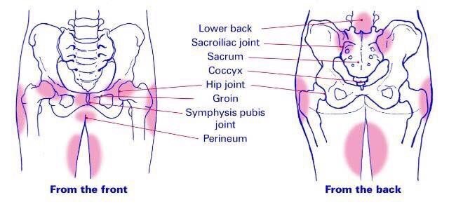 therehabphysios's tweet photo. PELVIC GIRDLE PAIN - PGP
Women report pain as the main symptom of PGP, whilst walking, bending, climbing stairs or turning in bed.
PGP is treatable with Physiotherapy &amp; Rehabilitation. Book a Women’s Health Physiotherapy Assessment if you need our help. 
#pelvichealth #pilates https://t.co/yLExybqroO