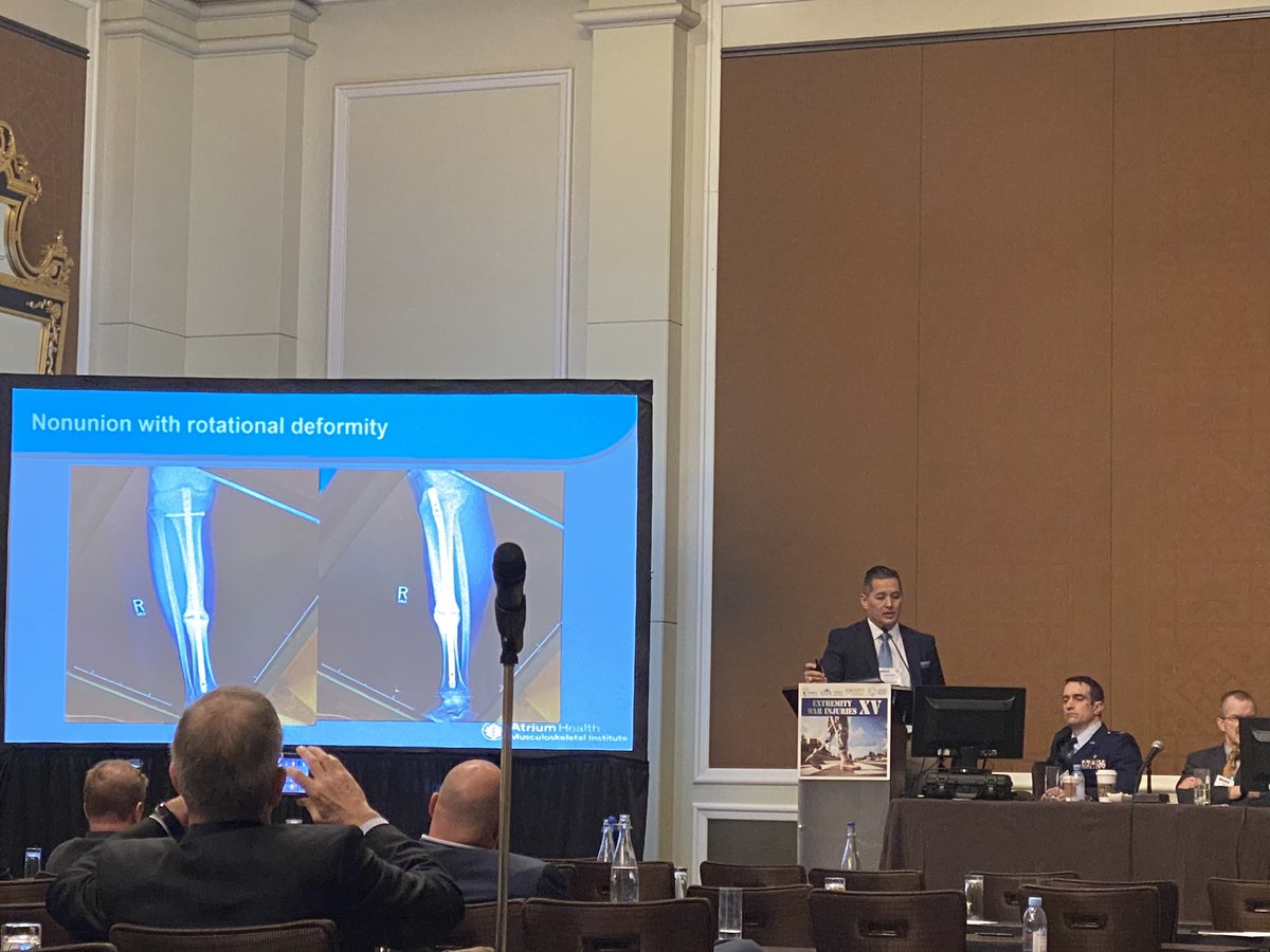 AnnaMillerMD's tweet photo. @JosephHsuMD educating #EWIXV on nonunions #envelopepusher @Str8bonesJim https://t.co/w8NIUi9rIp
