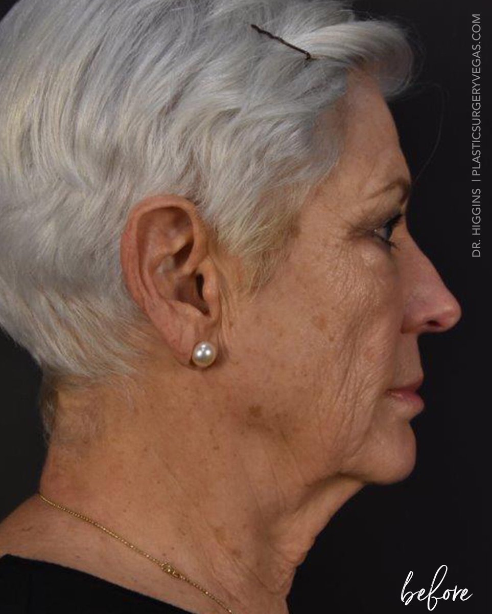 PlasticSurgeryVegas tweet media