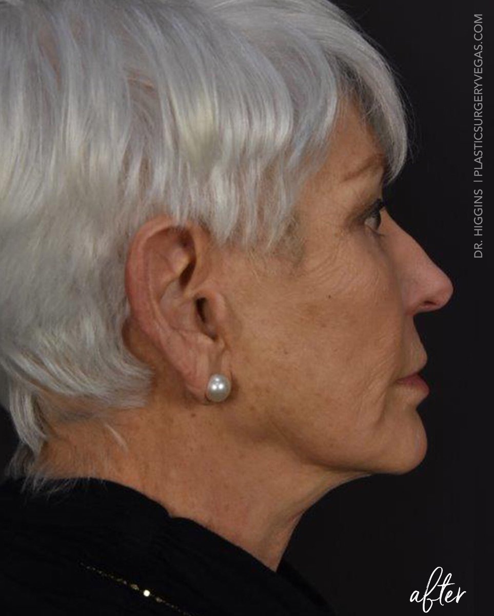 PlasticSurgeryVegas tweet media