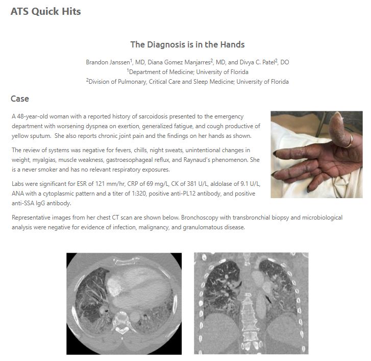 ATS_Assemblies tweet media