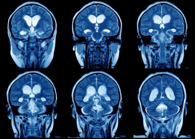 LaGazettedeGaia's tweet image. Qu’Arrive-t-Il au Cerveau de Quelqu'un Quand Il se Plaint Trop  #Cerveau #Neuroplasticité #SePlaindre lagazettedegaia.com/quarrive-t-il-…
