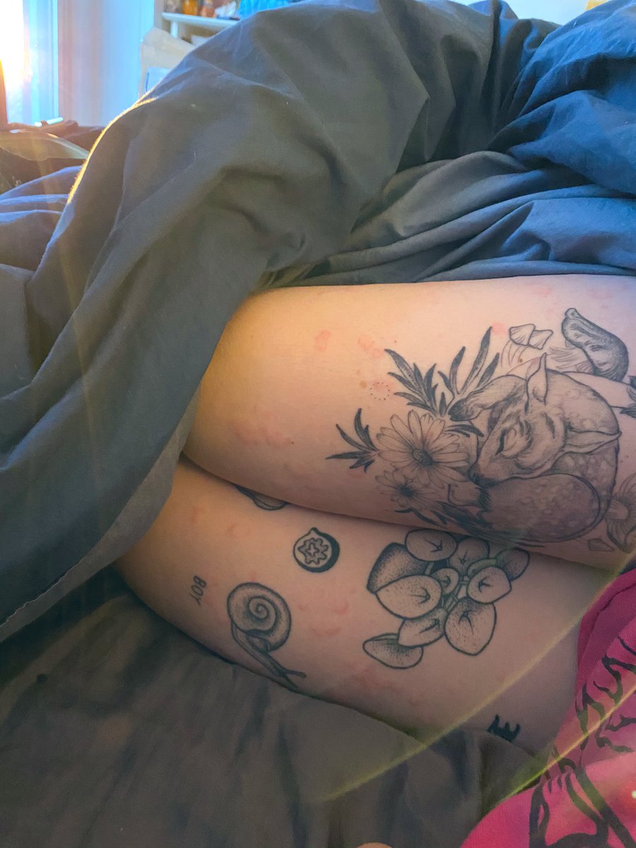 beefy_burrito's tweet photo. in honor of having chronic idiopathic urticaria aka chronic random hives i am starting my own hashtag #hivecheck. get it like vibe check. anyways i’m itchy as fuck https://t.co/qwqRGgfzfE