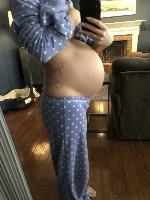 Gained 7 lbs and gained a basketball type belly...eviction notice coming soon for this little bundle<a href="/tag/monday"class="tags"><span>#monday</span></a><a href="/tag/birthdaysuit"class="tags"><span>#birthdaysuit</span></a><a href="/tag/teaganpresley"class="tags"><span>#teaganpresley</span></a>