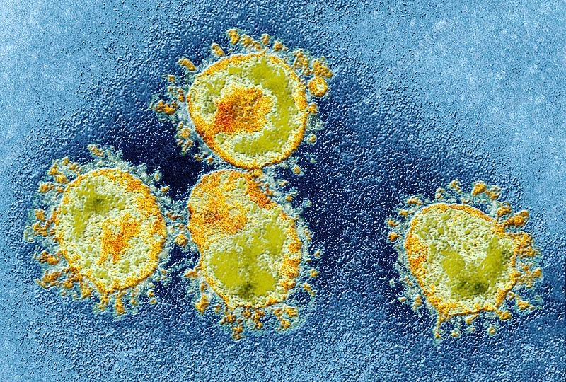 ImgenesMicrosc1's tweet photo. Micrografía electrónica de transmisión coloreada (TEM) de partículas de #coronavirus humano. https://t.co/TpQmqCWJEX