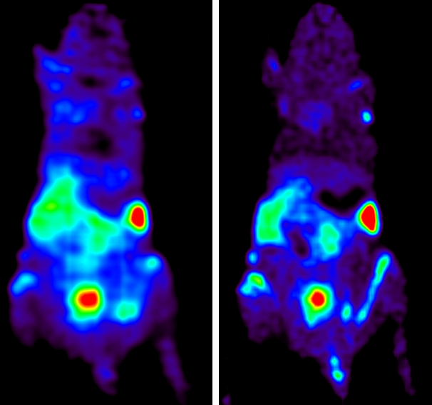 ClarkLabUCLA's tweet photo. Finally getting a chance to analyze comparisons we did between our old PET scanner and new hi-res PET scanner (prototype of @sofiebio GNEXT).  Clearer lymph nodes, less background - I'm impressed! https://t.co/C3NKiKN21z