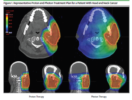JackWestMD's tweet photo. Join me, @HenningWillers, &amp; @subatomicdoc on 1/30, 9 PM ET as we do @JAMAOnc journal club on recent paper on #ProtonTherapy w/chemo for various loc adv #cancers. Should better tox but no diff in efficacy v photon RT change practice? Details, paper:
https://t.co/8XexVM3pih
#RadOnc https://t.co/jBTI6q6Ez7