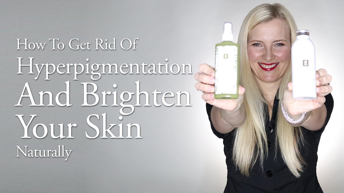 eminence hyperpigmentation