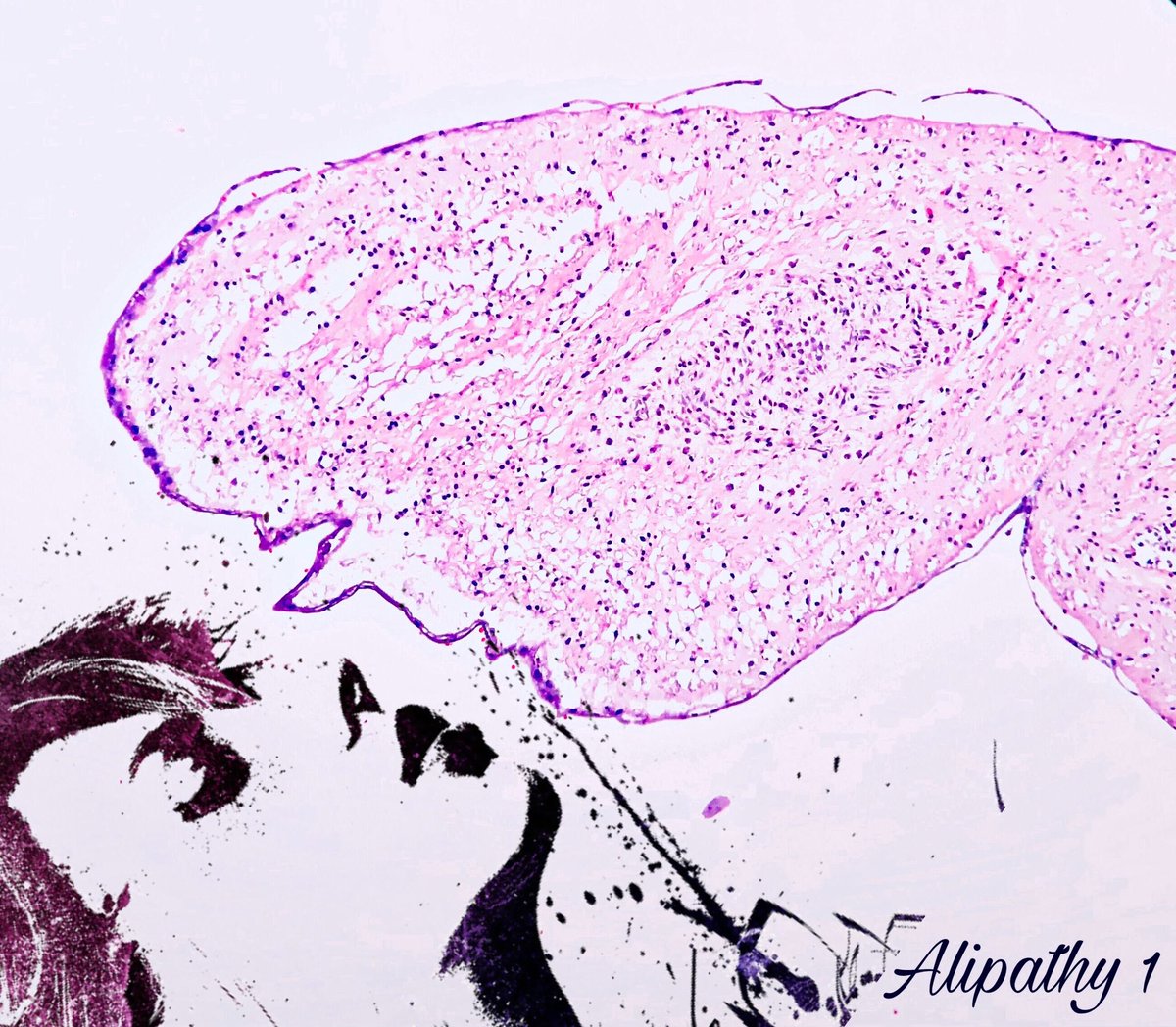 Alipathy's tweet photo. Amnios Man in #PathArt #pathreidolia #pareidolia #amnios https://t.co/h4IkB2dKbW