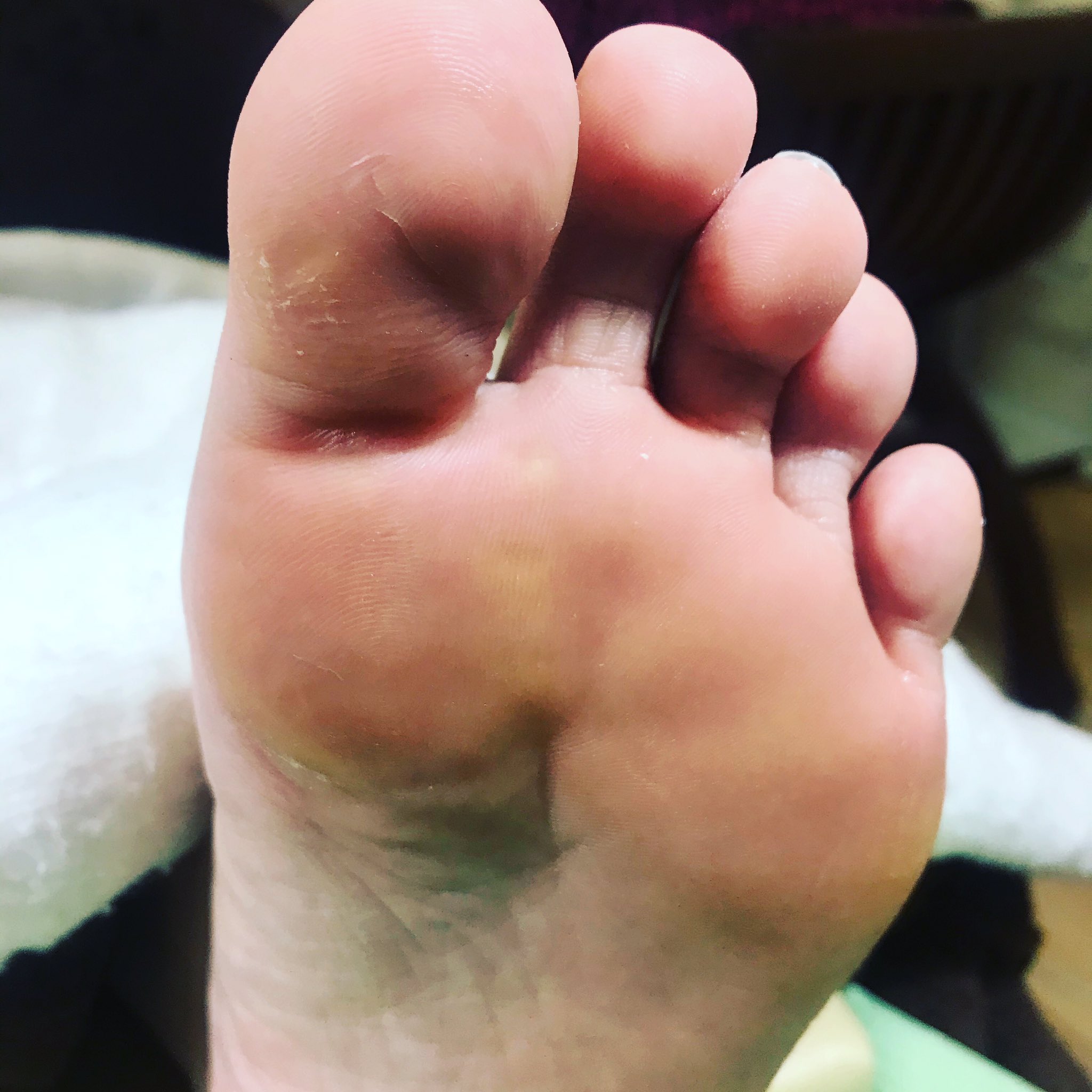 足裏角質 Twitter Search Twitter