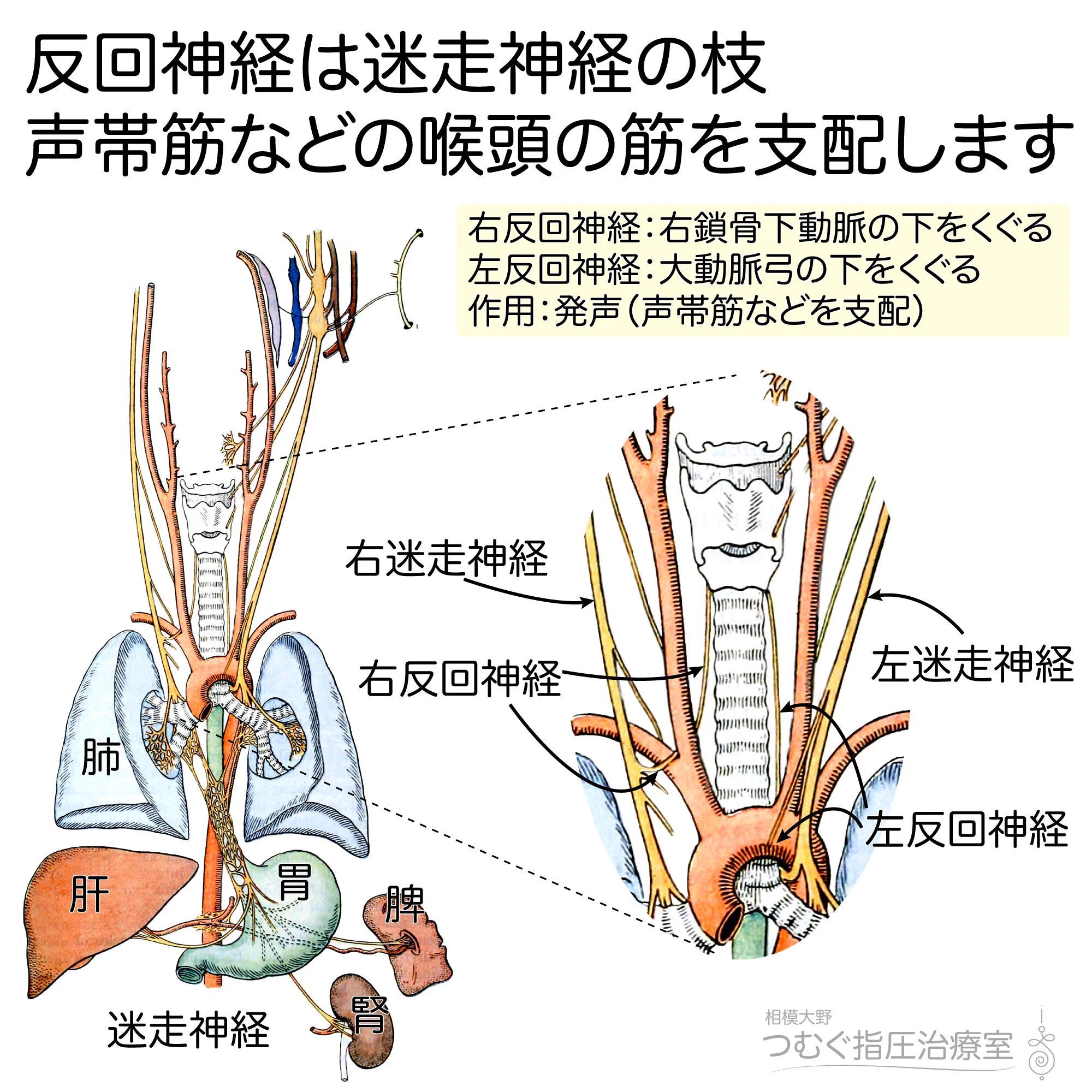 反 回 神経 麻痺 と は