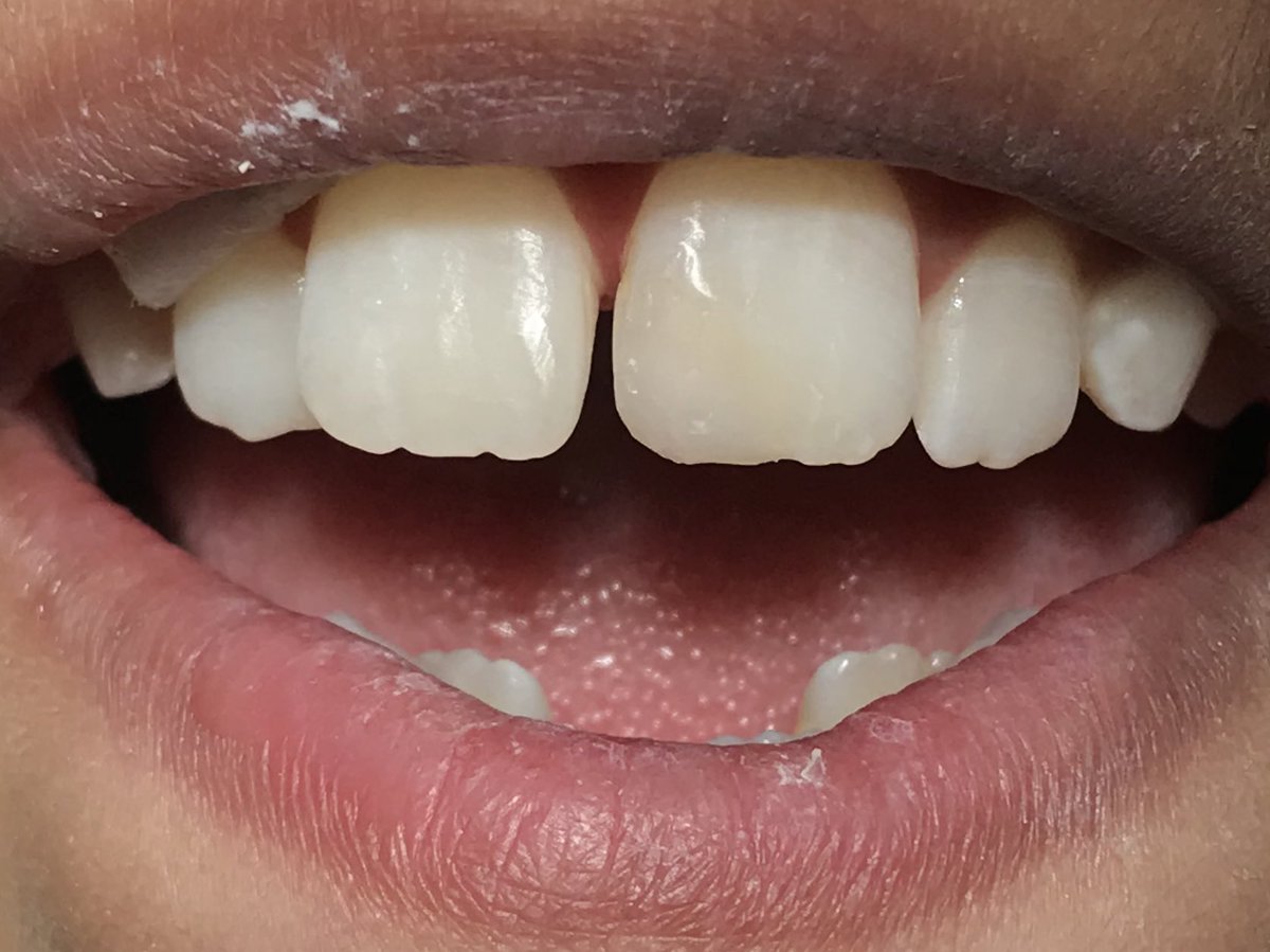 Mohammad Alotaibi tweet media