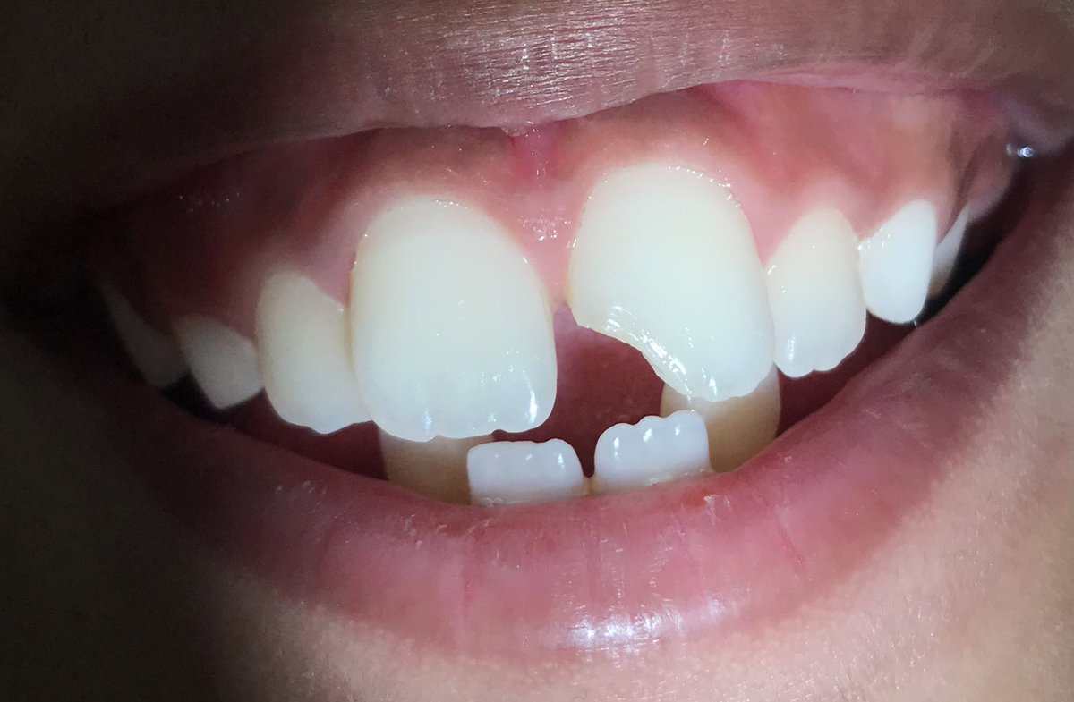 Mohammad Alotaibi tweet media